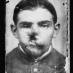 Negatyw - fotografia przedstawiająca francuskiego żołnierza, którego twarz została okaleczona podczas I wojny światowej, 17.10.1918 r., Biblioteka Kongresu USA